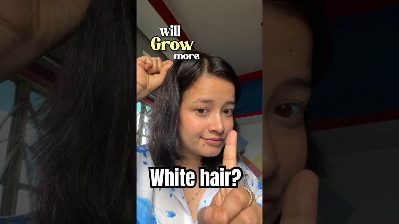 White hair problem in your early 20s? | Trimming white hair | Hair habits | Haircare 