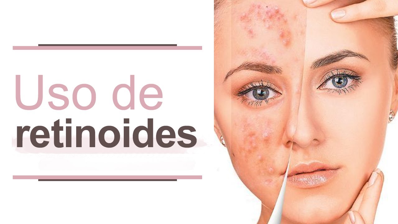 Guía para el uso de retinoides l Dra. María Clara Mejía YouTube Guía para el uso de retinoides l Dra. María Clara Mejía YouTube