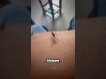 How Mosquitoes Extract Blood 😮