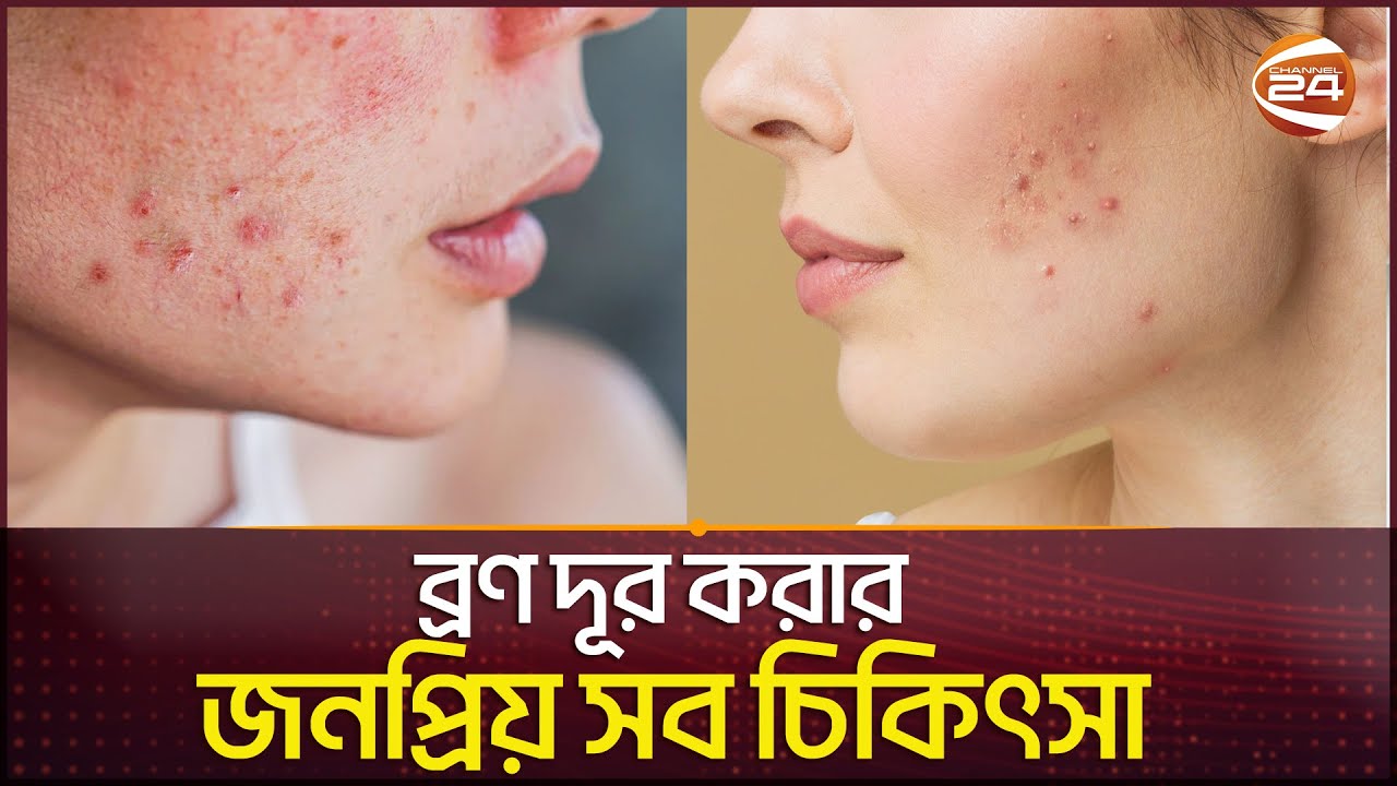 Pimple Skin Care Channel 24 men-s-skin-care-channel-24-youtube