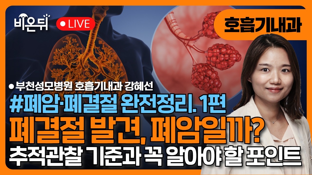 [폐암·폐결절 완전정리] 1. 폐결절 발견, 폐암일까? – 추적관찰 기준과 꼭 알아야 할 포인트 / 부천성모병원 호흡기내과 강혜선