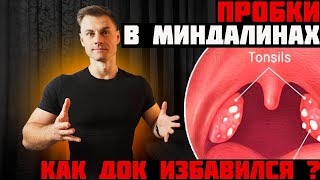 Пробки в горле. Как ДОК избавился!?