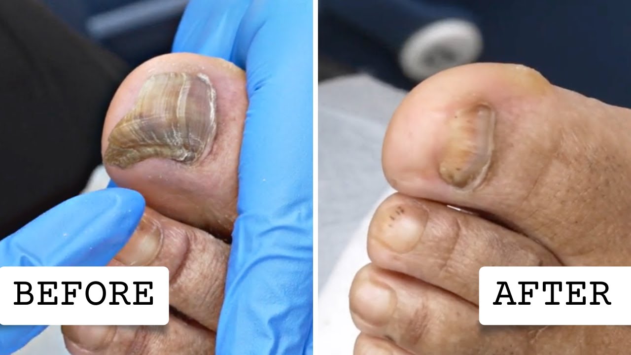 Toenail Cutting Pedicure On The Street 👣 YouTube