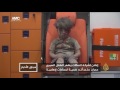 تزييف للوقائع وطمس للحقيقة غضب لإعلان يجسد شخصية الطفل السوري عمران 
