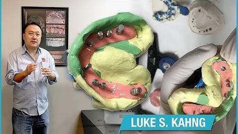 How to Make a Great Soft Tissue Model from the Lab Analog