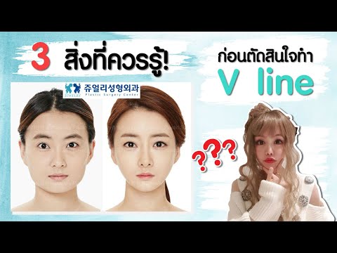3 สิ่งที่ควรรู้ก่อนตัดสินใจทำวีไลน์ (V line) #ศัลยกรรมเกาหลี