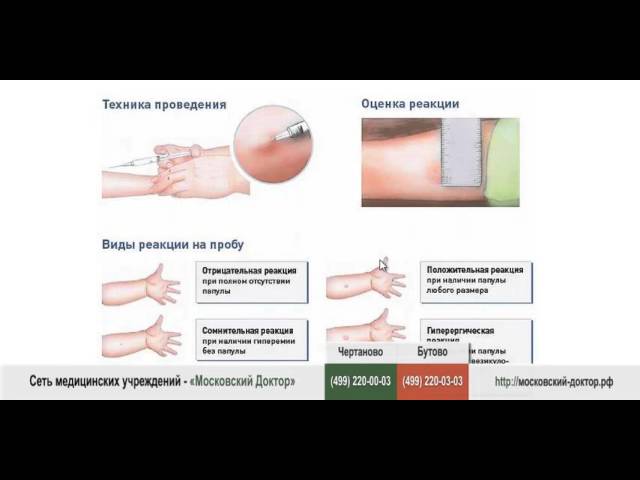 Аллергическая реакция на прививки