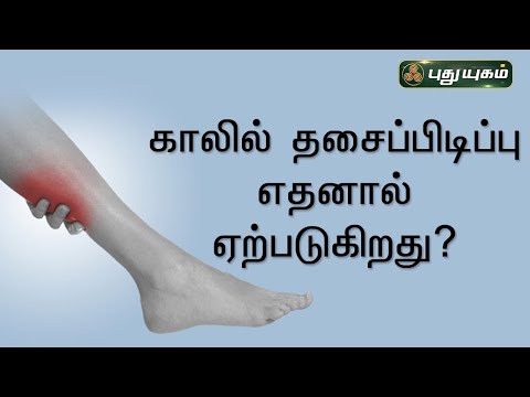 காலில் தசைப்பிடிப்பு (Leg cramps) எதனால் ஏற்படுகிறது? Dr.M.S.UshaNandhini | PuthuyugamTV