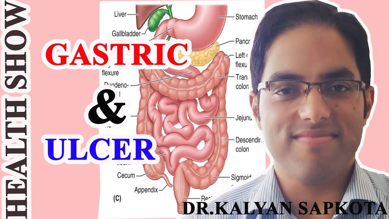 ग्यास्ट्रीकले अलसर, अलसरले क्यान्सर हुनसक्छ है विचार गर्नु होला //By Dr.Kalyan Sapkota //Episode 5