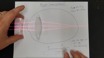 Vision Correction (Normal Eyes, Myopia, Hyperopia, Near & Far Point, Lens Power)