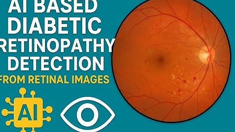 AI Based Diabetic Retinopathy Detection from Retinal Images