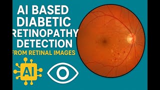 AI Based Diabetic Retinopathy Detection from Retinal Images