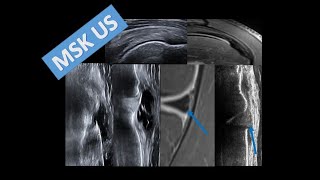 How to Do Diagnostic and Interventional Musculoskeletal Ultrasound:  A Primer for Practice and Exams screenshot 1