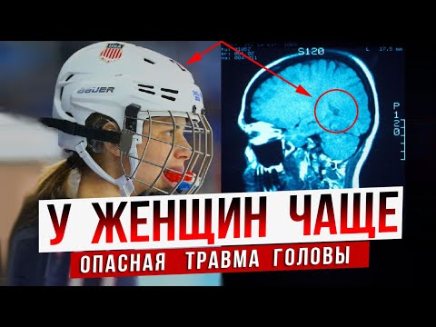 Почему у женщин сотрясение мозга чаще | Хоккей | Спорт