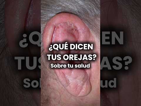 Tus orejas pueden revelar enfermedades que no imaginas #dermatologia #dermatologo #medicina #shortts