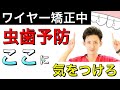 【ワイヤー矯正中】虫歯にならないための３つの方法
