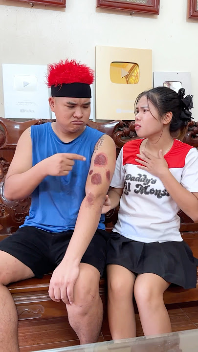 Bạn gái tôi đã vô tình gây vết thương cho tôi mà không biết 😱😣😙🤪