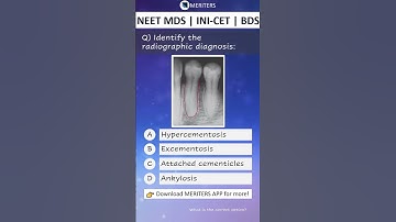 NEET MDS | INI-CET MDS | PSC | BDS - Most Important Questions  #neetmds2025 #mdsprep