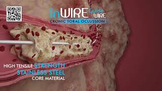 InWire Guidewire CTO