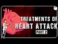 Treatments of Heart Attack | Part-2 | PuStack