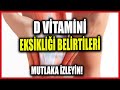 D Vitamini Eksikliğiniz Olduğunu Gösteren 13 Belirgin İşaret