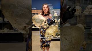 Why Did Ancient People Elongate Their Skulls