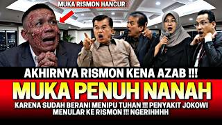 BERANI MENIPU TUHAN‼️ AKHIRNYA RISMON KENA AZAB😱‼️ MUKA RUSAK PENUH NANAH, SAMA SEPERTI JOKOWI