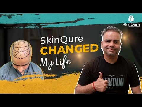 Hair Transplant Consultation: What to Expect in Delhi - video