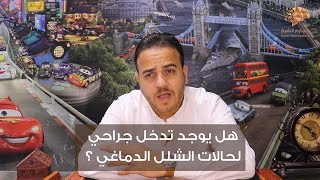 س21 هل يوجد تدخل جراحي لحالات الشلل الدماغي ؟ سلسلة 100 س وج في مخ وأعصاب الأطفال | د. حازم الشيخ