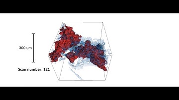 Intermittent flow dynamics