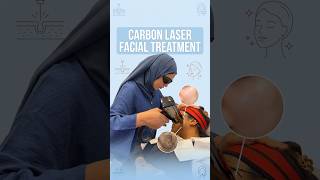 Refresh Your Skin with a Carbon Laser Facial #CarbonLaserFacial #CarbonLaser #SkinRejuvenation