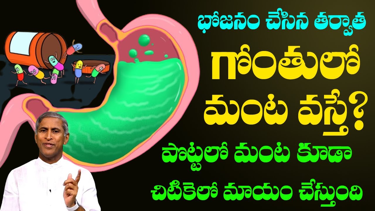 Acid Reflux Home Remedies | భోజనం చేసిన తరువాత గొంతులో మంట వస్తే ? | Dr Manthena Satyanarayana Raju