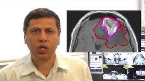 Segasist Cloud for Quality Assurance in Cancer Radiation Therapy