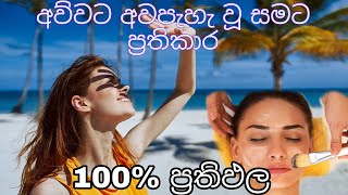 අව්වට පිලිස්සුන සමට මිනිත්තු 20න් සත්කාරය