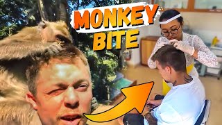 Bitten By A Monkey In Bali Indonesia
