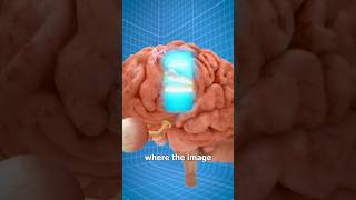 How You See Things  Surgeon Reacts