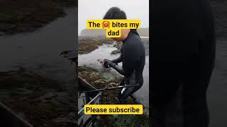 The Crab Bites My Dad