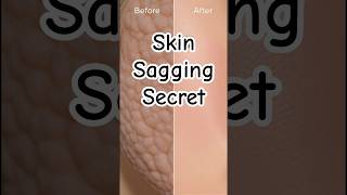 Why Your Skin Looks Saggy & Pores Are Bigger After 60 #skincareover60 #healthyaging #antiagingtips