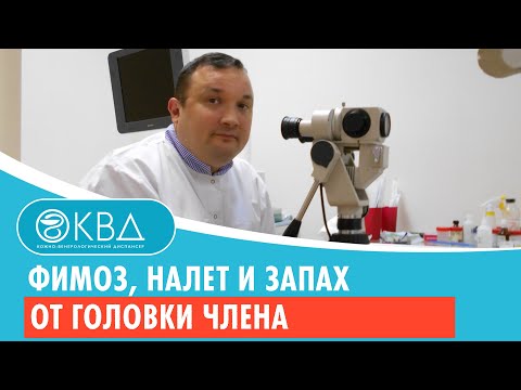 💣 Фимоз, налет и запах от головки члена. Клинический случай №429