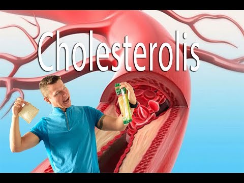 Video: Ar Cholesterolis Yra Lipidas?