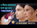 মুখের কালো দাগ ও মেচেতা দূর করুন সহজ টোটকায় | Natural Skin Whitening Pack