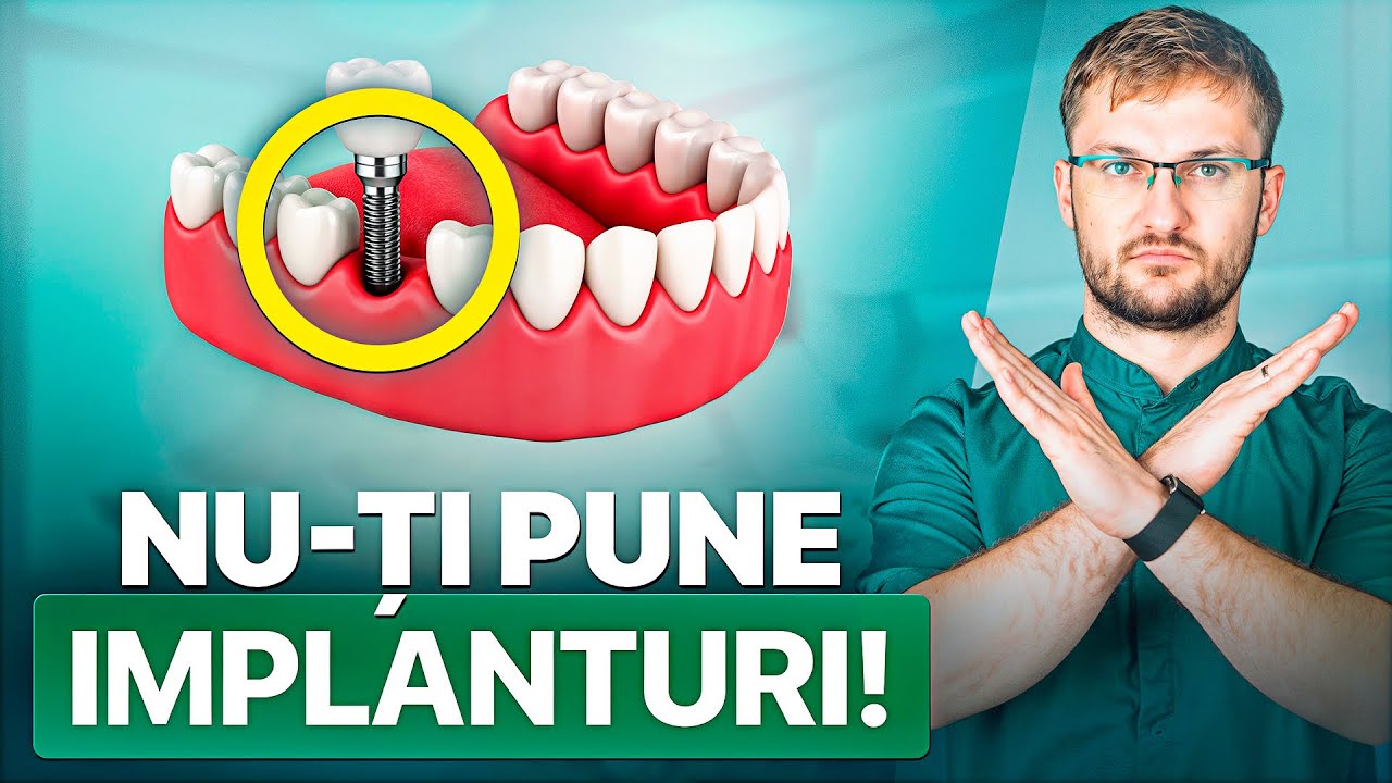 Vă este INTERZIS să puneți IMPLANTURI DENTARE dacă… / Stomatologii nu vă spun asta!
