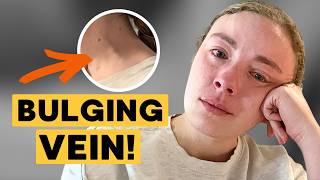 My Stage 4 Cancer Was Caught By ACCIDENT In The Emergency Room! “I thought, am I going to die”