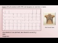 EKG and Heart Murmur Review - Part 1