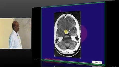 NEETPG Image based MCQ Mock Test Discussion 1622 Lec 02 Download uMedico App