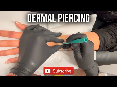 Vídeo: Quem remove piercings dérmicos?