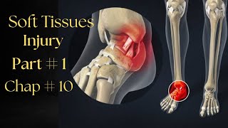 Soft tissues Injuries [ Part-1] Chapter#10 Therapeutics screenshot 3