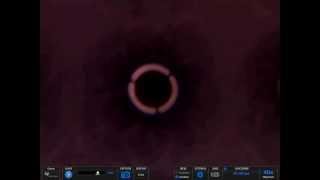 Vibration of Microbubble Membrane driven by Ultrasound at 28kHz, D100um