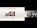 Madeline Lancaster: “Understanding human brain structure and function with cerebral organoids”