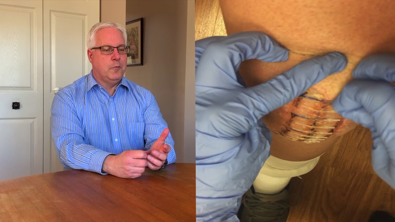 John Szalinski - Zip Removal Experience